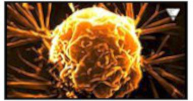 Billigt och relativt s�kert l�kemedel som d�dar de flesta typerna av cancer?